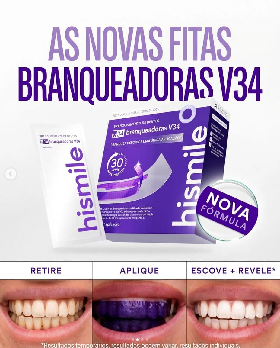 Antes e depois do clareamento com HiSmile V34 - Retire, Aplique, Escove e Revele